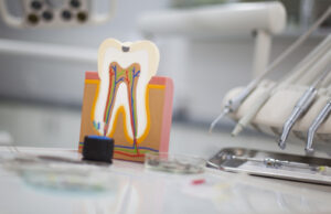 Как происходит лечение каналов зуба