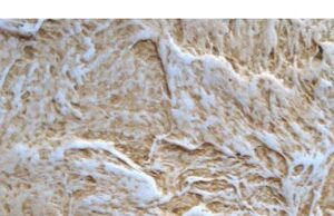 Декоративная штукатурка: виды и особенности